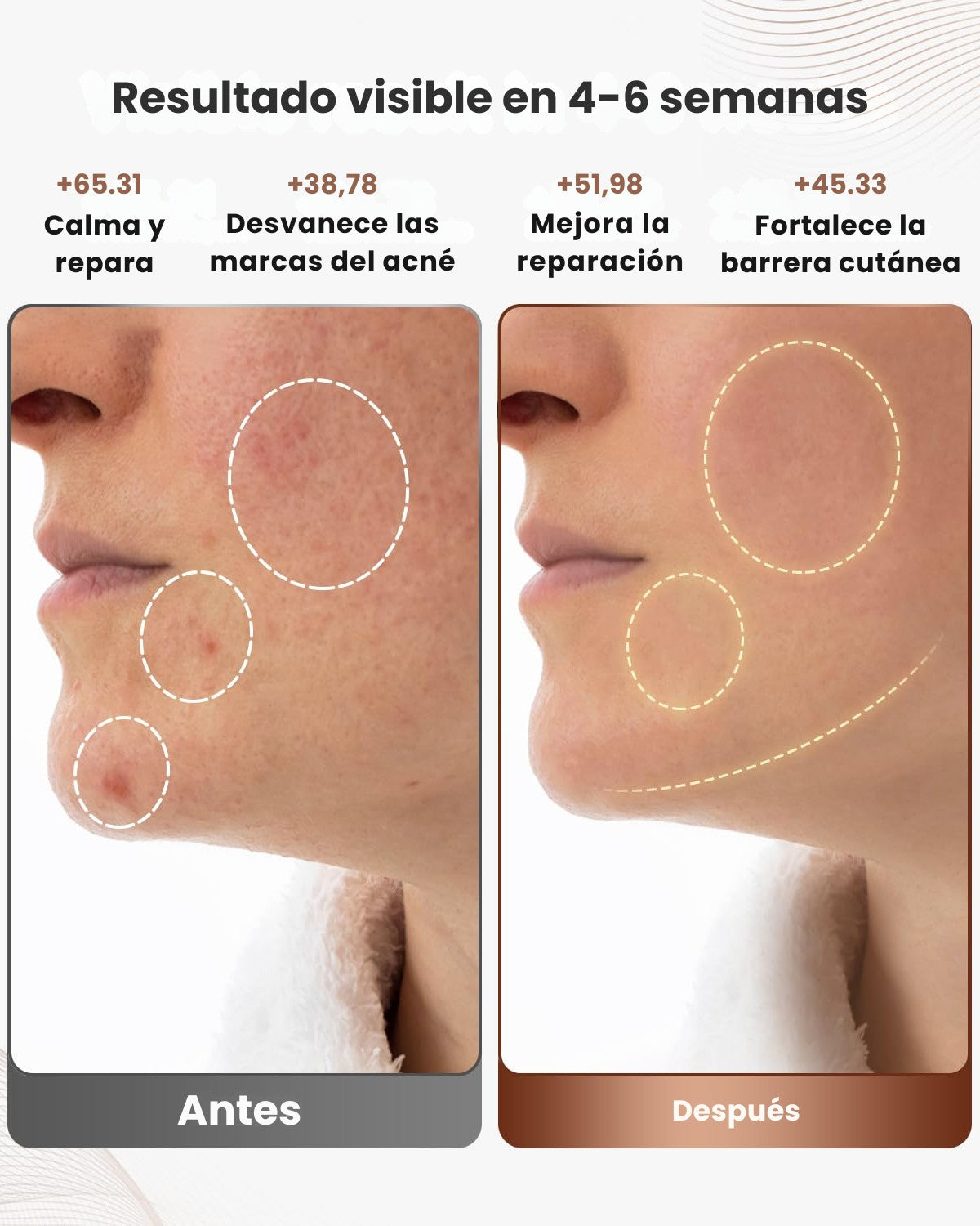 Máscara LED antienvejecimiento: Rejuvenece tu piel con BeautyMask®