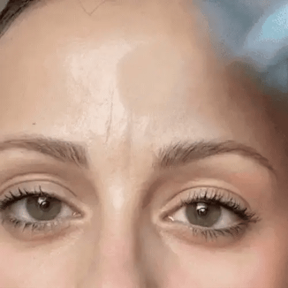 CANDY BELLA - GEL MATIFICANTE PARA CONTROL DE PIEL GRASA 🌸